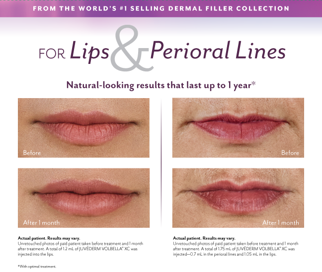 Volbella Information