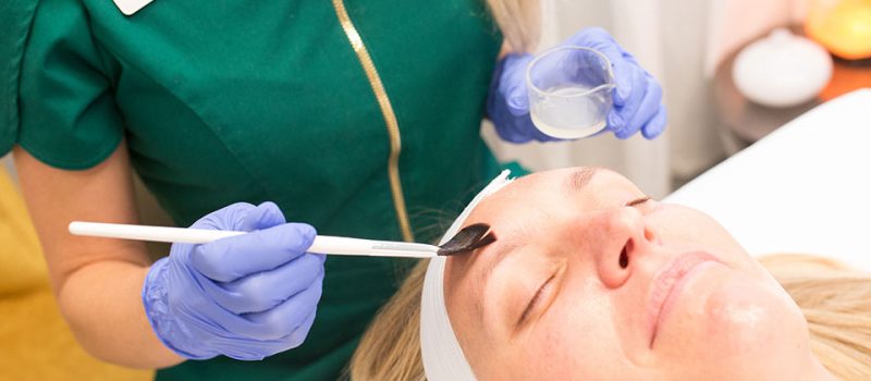 What Is A Chemical Peel?