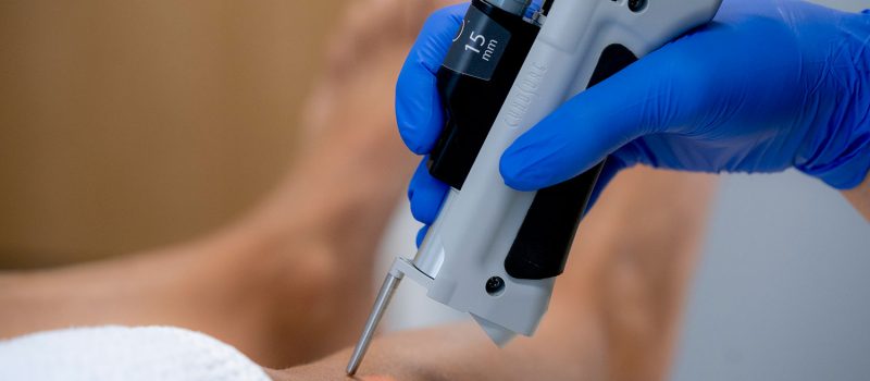 5 Eye Opening Reasons Why More Adults Are Getting Laser Hair Removal